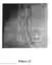 Fig. 23 - Thermoplastic Polymer Based Nanocomposites