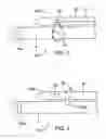 Fig. 02 - Endoscopic tube delivery system