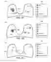 Fig. 08 - Processing and displaying dynamic contrast-enhanced magnetic resonance imaging information