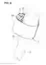 Fig. 09 - DISPOSABLE BAND FOR A COMPRESSION DEVICE