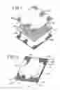 Fig. 02 - Medical device and process