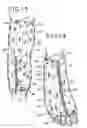Fig. 07 - Medical device and process