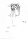 Fig. 02 - Electroactive polymer actuated cerebrospinal fluid shunt