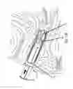Fig. 20 - Therapeutic intra-vaginal devices and methods