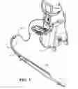 Fig. 02 - Irrigation/aspiration system
