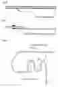 Fig. 07 - Thrombus Suction Catheter With Excellent Crossability