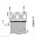 Fig. 07 - Catheter assembly having a modified reinforcement layer
