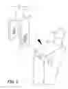 Fig. 04 - Orthopedic and dental implant system and method