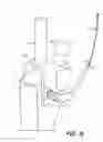 Fig. 09 - Orthopedic and dental implant system and method