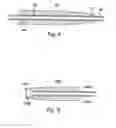 Fig. 05 - Devices for minimally invasive pelvic surgery