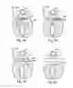 Fig. 28 - Devices for minimally invasive pelvic surgery
