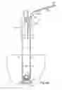 Fig. 44 - Devices for minimally invasive pelvic surgery
