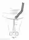 Fig. 55 - Devices for minimally invasive pelvic surgery