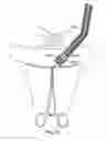 Fig. 56 - Devices for minimally invasive pelvic surgery