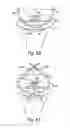 Fig. 64 - Devices for minimally invasive pelvic surgery