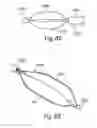 Fig. 65 - Devices for minimally invasive pelvic surgery