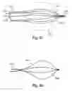 Fig. 67 - Devices for minimally invasive pelvic surgery