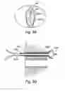Fig. 68 - Devices for minimally invasive pelvic surgery