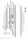 Fig. 74 - Devices for minimally invasive pelvic surgery