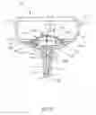 Fig. 06 - Vacuum Extractor And Method Of Use Therefor