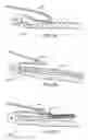 Fig. 07 - Methods and apparatus for transpericardial left atrial appendage closure