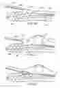 Fig. 09 - Methods and apparatus for transpericardial left atrial appendage closure