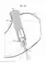 Fig. 09 - Gastrotomy closure device