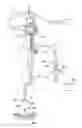 Fig. 01 - Treatment tool for endoscope