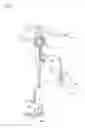 Fig. 02 - Treatment tool for endoscope