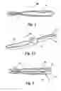 Fig. 02 - Encased tweezers