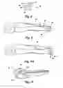 Fig. 07 - Encased tweezers