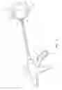 Fig. 02 - Extraluminal sealant applicator and method