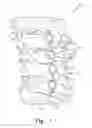 Fig. 02 - Low profile vertebral stabilization systems and methods