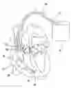 Fig. 01 - Heart stimulator using a Bezier function to define AV-delay values