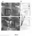 Fig. 06 - Method of treating mood disorders and/or anxiety disorders by brain stimulation