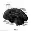 Fig. 02 - Responsive Therapy for Psychiatric Disorders