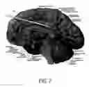 Fig. 08 - Responsive Therapy for Psychiatric Disorders