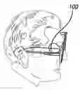 Fig. 01 - Apparatus and method for electrical stimulation of human neurons