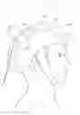 Fig. 01 - Low level light therapy for enhancement of neurologic function of a patient affected by Parkinson's disease
