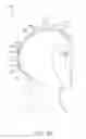 Fig. 22 - Low level light therapy for enhancement of neurologic function of a patient affected by Parkinson's disease