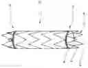 Fig. 01 - PROXIMAL FIXING