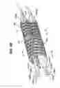 Fig. 09 - Method for placing a medical device at a bifurcated conduit