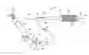 Fig. 01 - Stent delivery apparatus and method