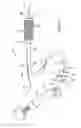 Fig. 02 - Stent delivery apparatus and method