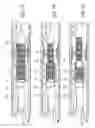 Fig. 09 - Stent delivery apparatus and method