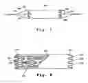 Fig. 03 - Stent graft assembly and method