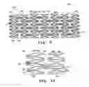 Fig. 04 - Stent graft assembly and method