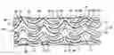 Fig. 01 - Vascular stent with composite structure for magnetic resonance imaging capabilities
