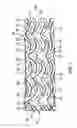 Fig. 02 - Vascular stent with composite structure for magnetic resonance imaging capabilities