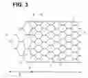 Fig. 04 - Medical implant having a curlable matrix structure and method of use